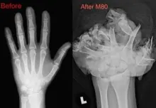 Hand before and after a firework explosion